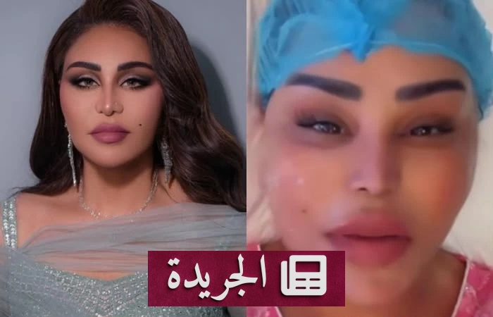 أحلام الشامسي تكشف عن إجراء تجميلي لشد الوجه وتستعرض نتيجته - آخر الأخبار - الجريدة