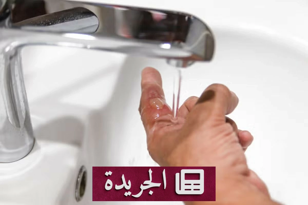 طبيب بريطاني يكشف الطريقة الصحيحة لتبريد الحروق - آخر الأخبار - الجريدة