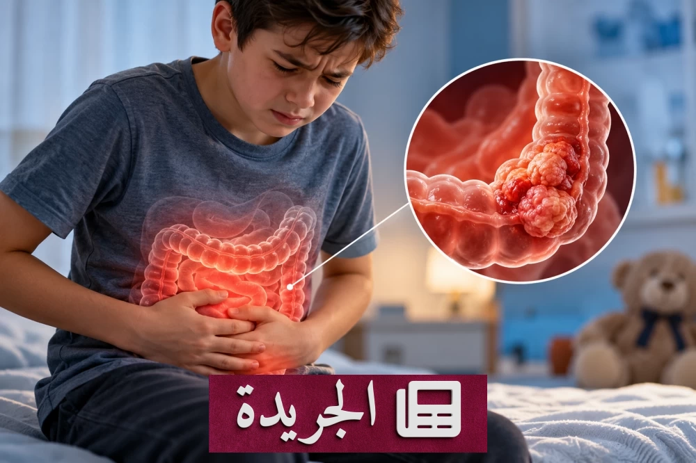 تحذير طبي من ارتفاع سرطان القولون والمستقيم بين الأطفال والمراهقين - آخر الأخبار - الجريدة