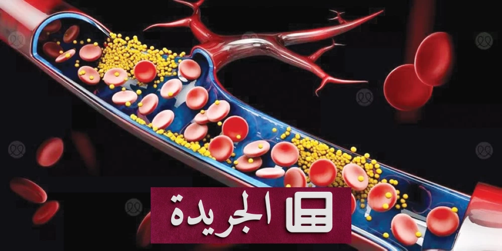 علاج الكوليسترول قد يزيل «المواد الكيميائية الأبدية» من الدم - آخر الأخبار - الجريدة