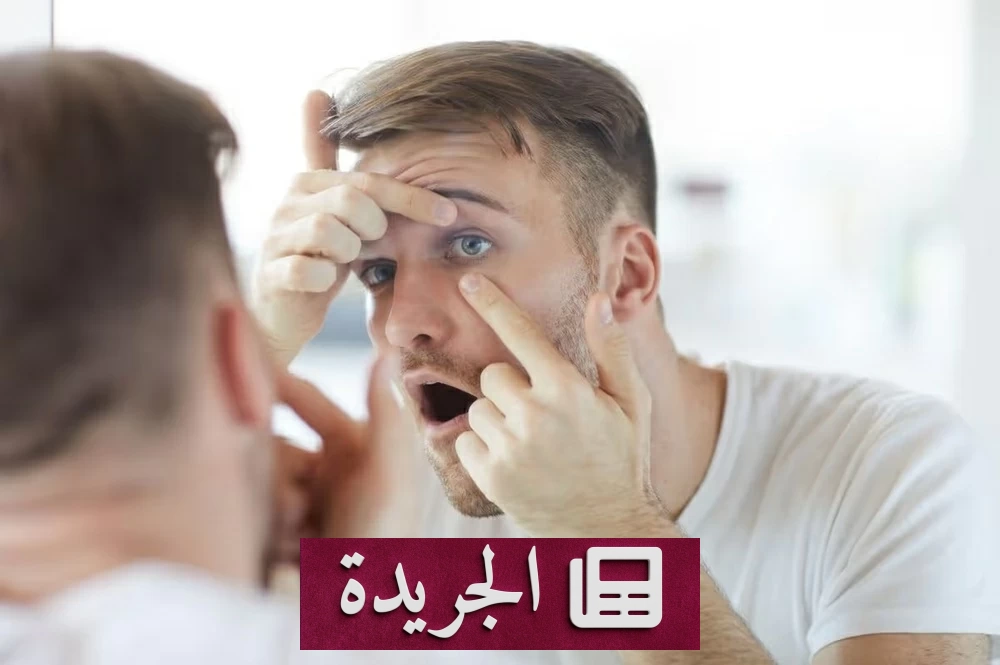 احمرار العين.. متى يكون خطرا يستدعي زيارة الطبيب - آخر الأخبار - الجريدة