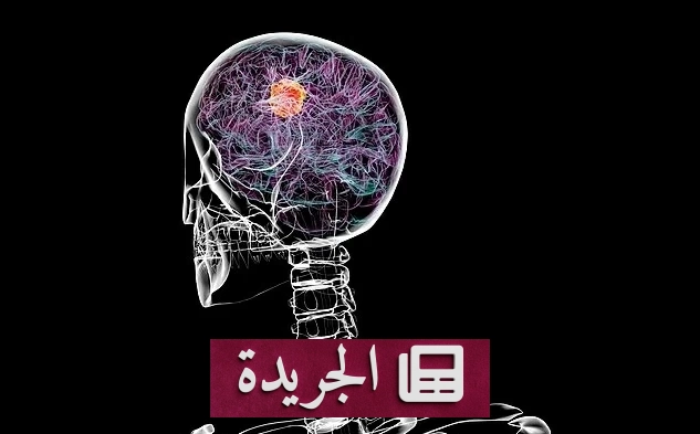 اكتشاف علاج مناعي واعد للقضاء على أخطر أورام الدماغ - آخر الأخبار - الجريدة