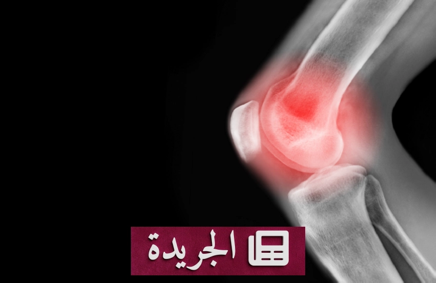 اكتشاف طبي ألماني يغير علاج التهاب مفصل الركبة دون جراحة - آخر الأخبار - الجريدة