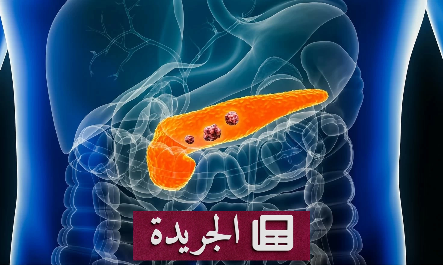 اكتشاف طبي مثير.. أدوية التخسيس قد تقلل خطر سرطان البنكرياس - آخر أخبار الجريدة