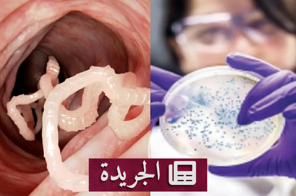 «السيكلوسبورا» يهاجم الولايات المتحدة ويصيب الآلاف عبر الغذاء الملوث - آخر أخبار الجريدة