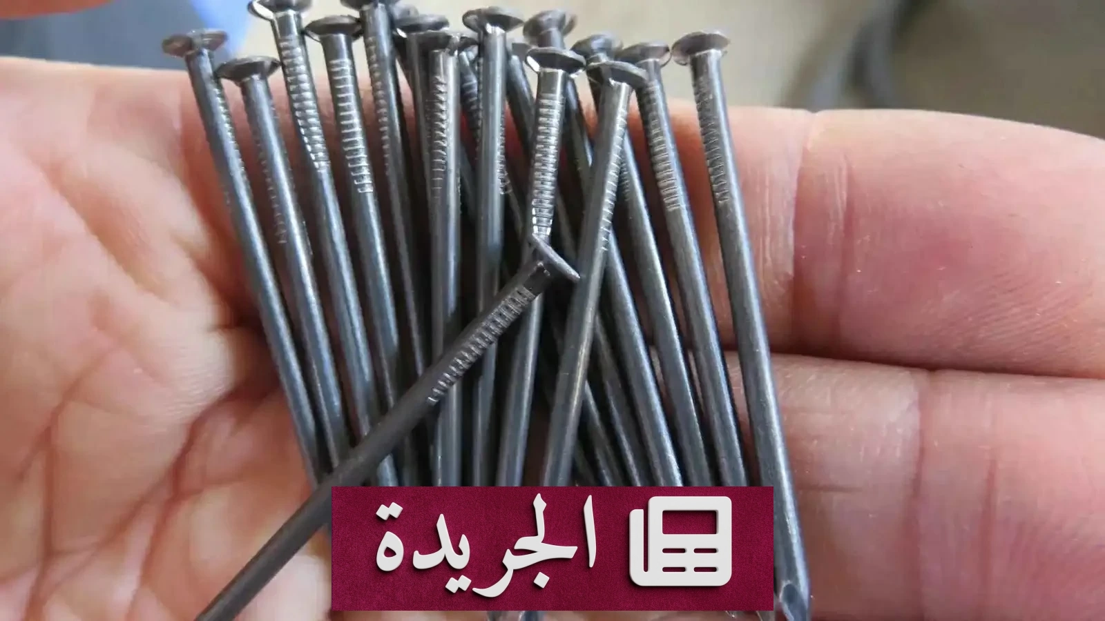 إنجاز طبي غير مسبوق في مصر باستخراج مائة مسمار من معدة مريض - آخر الأخبار - الجريدة