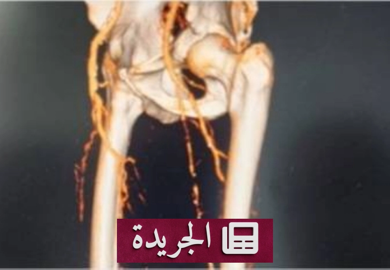 اشترك الآن في النشرة الإخبارية اليومية عبر بريدك الإلكتروني - آخر الأخبار - الجريدة