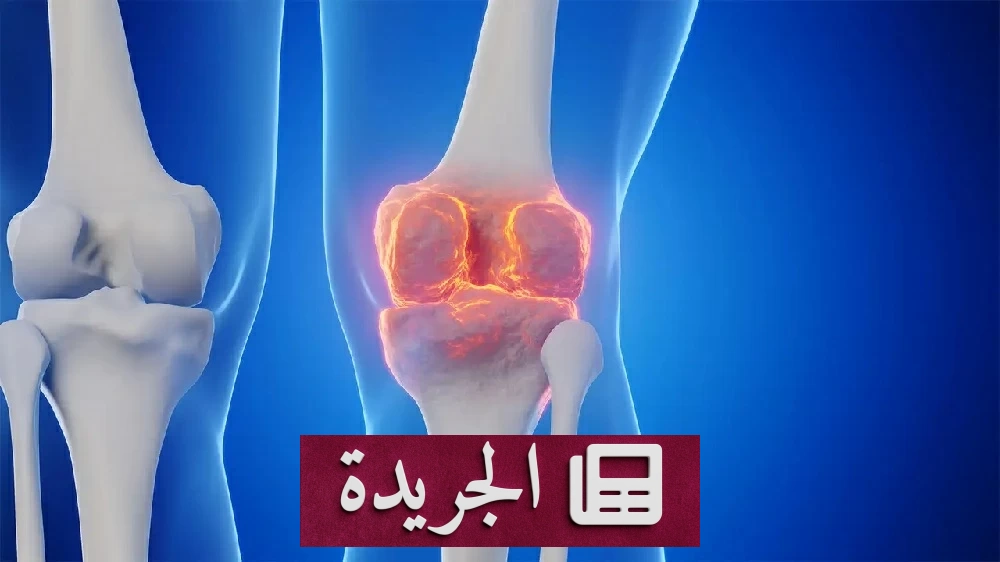 دواء السكري يتحول إلى درع لحماية مفاصل الركبة والورك من الخشونة - آخر أخبار الجريدة