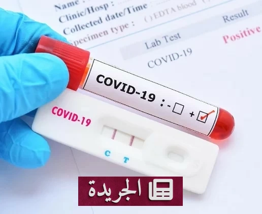 دواء فلوفوكسامين يفتح آفاقاً جديدة لعلاج الإرهاق المزمن لمرضى كوفيد طويل الأمد - أخبار أونلاين
