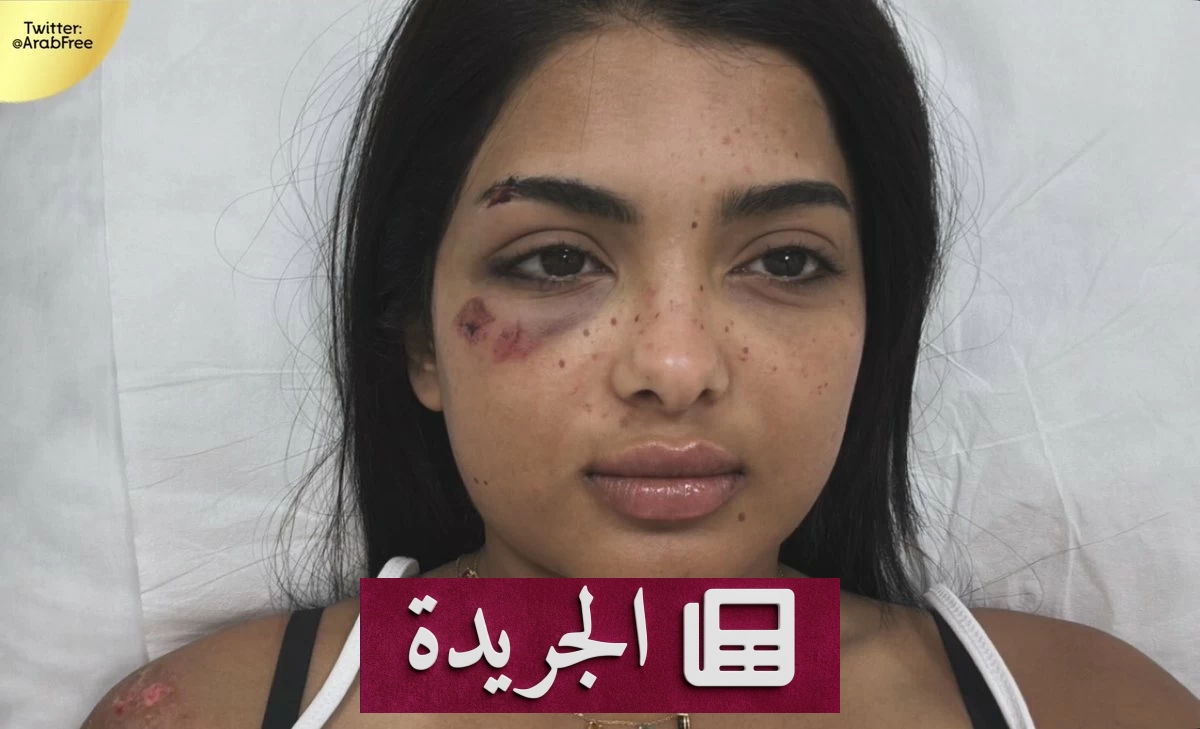 جود السفياني تكشف تفاصيل إصابتها في حادث مروري وتؤكد سلامتها - أخبار أونلاين