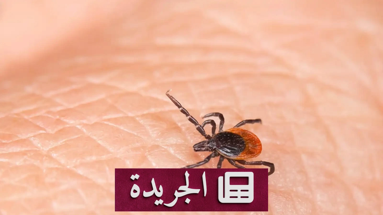 حشرة القراد تقضي على حياة حارس أمن تركي في ثلاثة أيام - آخر أخبار الجريدة