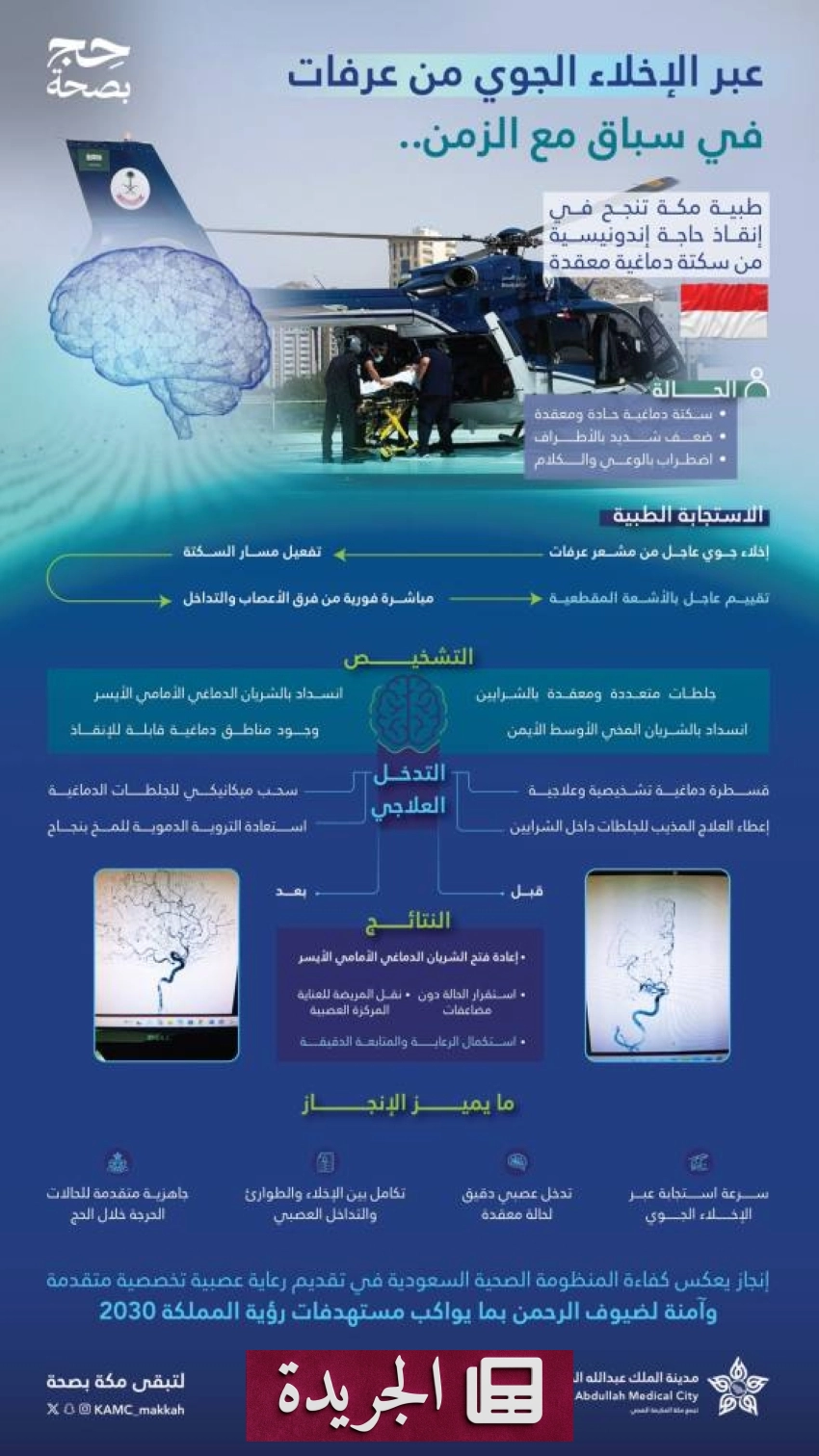 مركز طبي ينقذ حاجّة إندونيسية من سكتة دماغية حادة في عرفات - آخر أخبار الجريدة