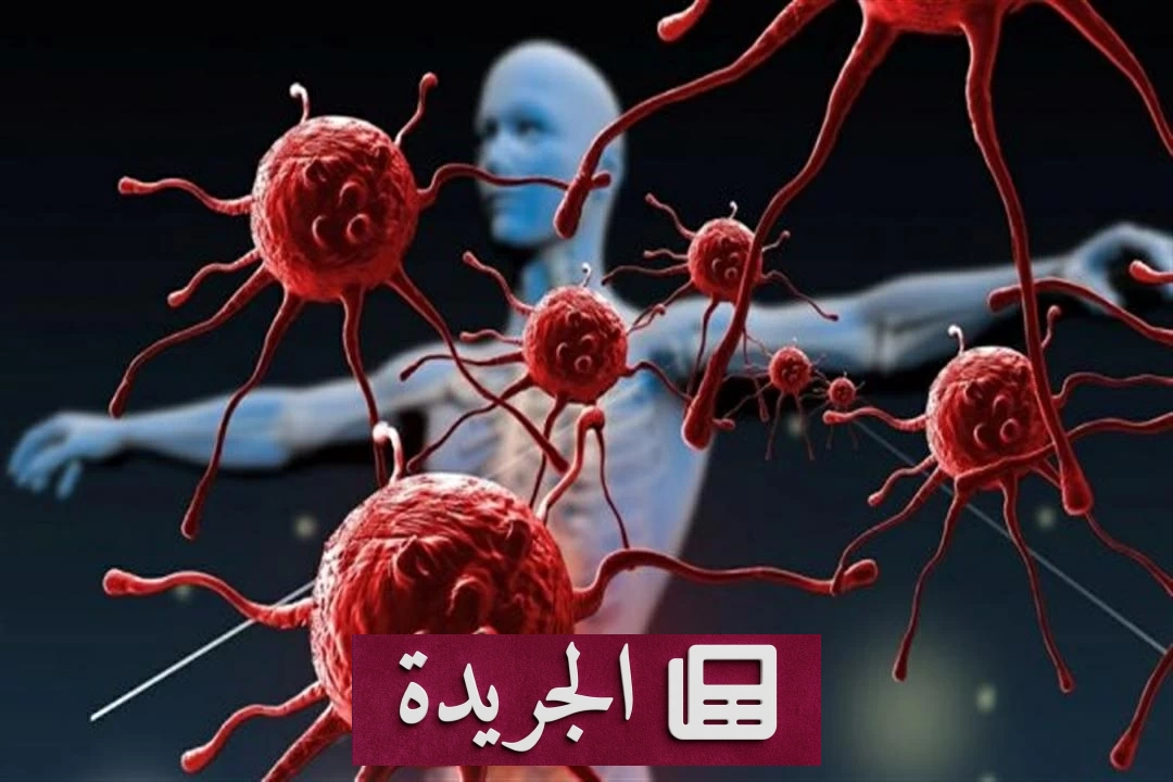 ثورة طبية جديدة.. علماء روس وصينيون يبتكرون ليزراً ذكياً يدمر أشد الأورام السرطانية - آخر الأخبار - الجريدة